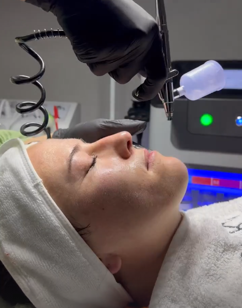 Cilt yenilenmesinin görseli