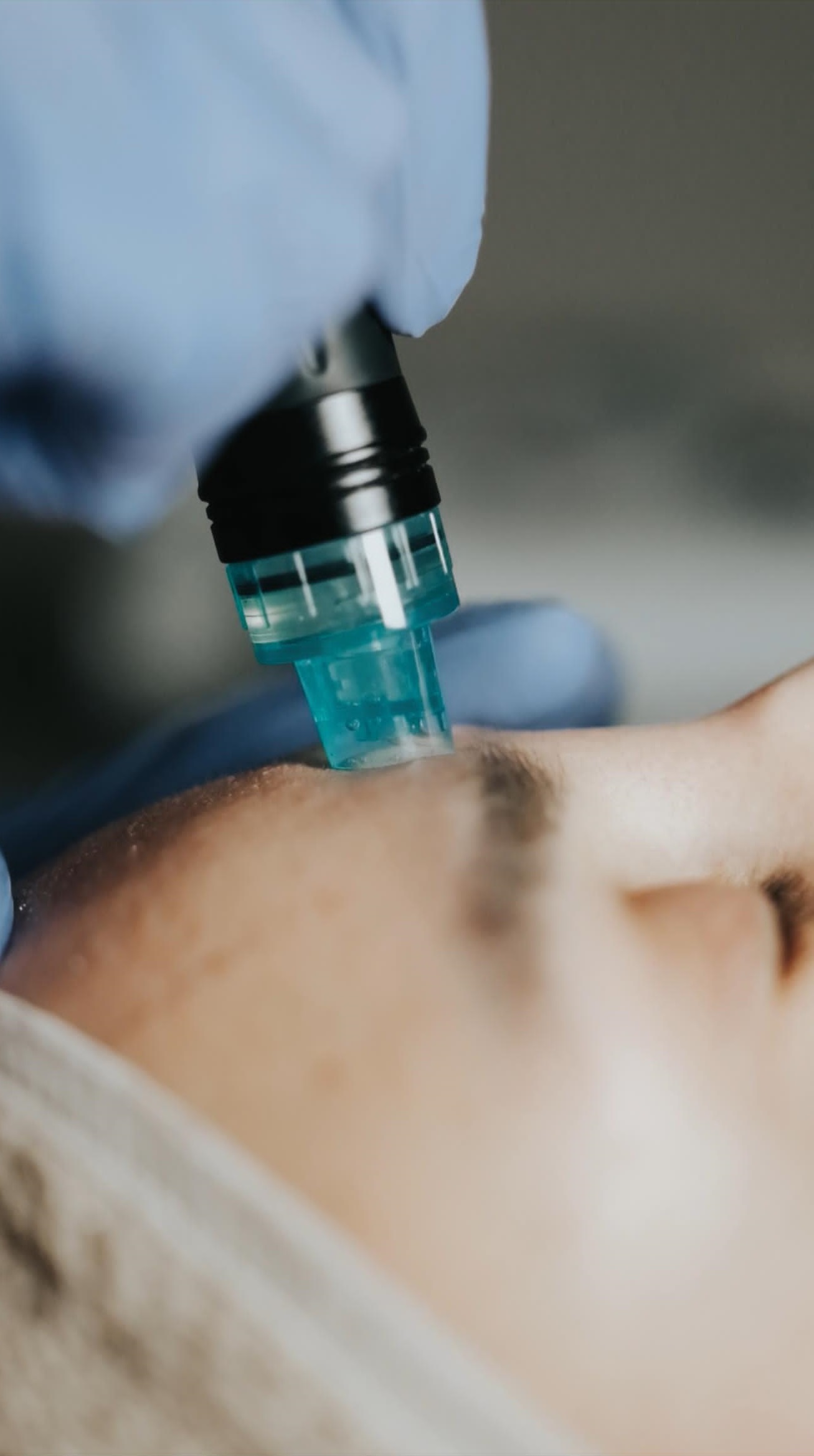 Alın bölgesi için hydrafacial görseli