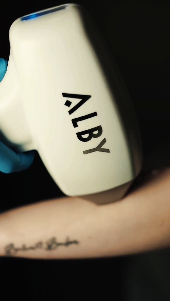 Alby buz lazer epilasyon cihazının görseli